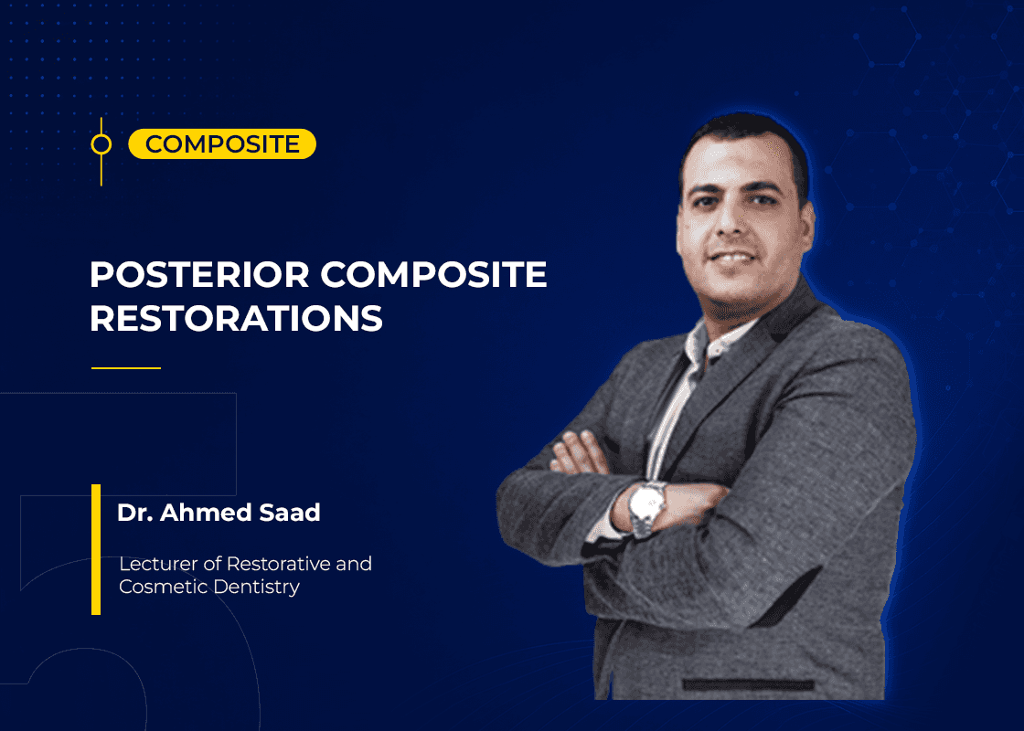 Posterior Composite Restorations