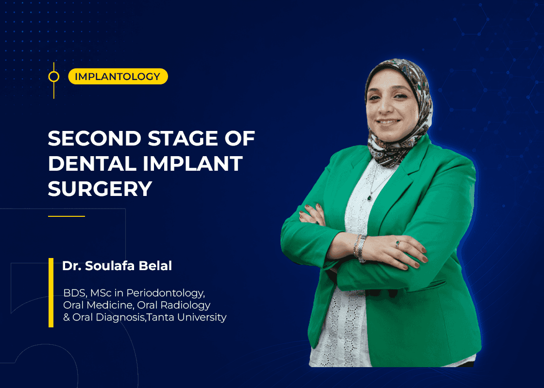 Second Stage of Dental Implant Surgery