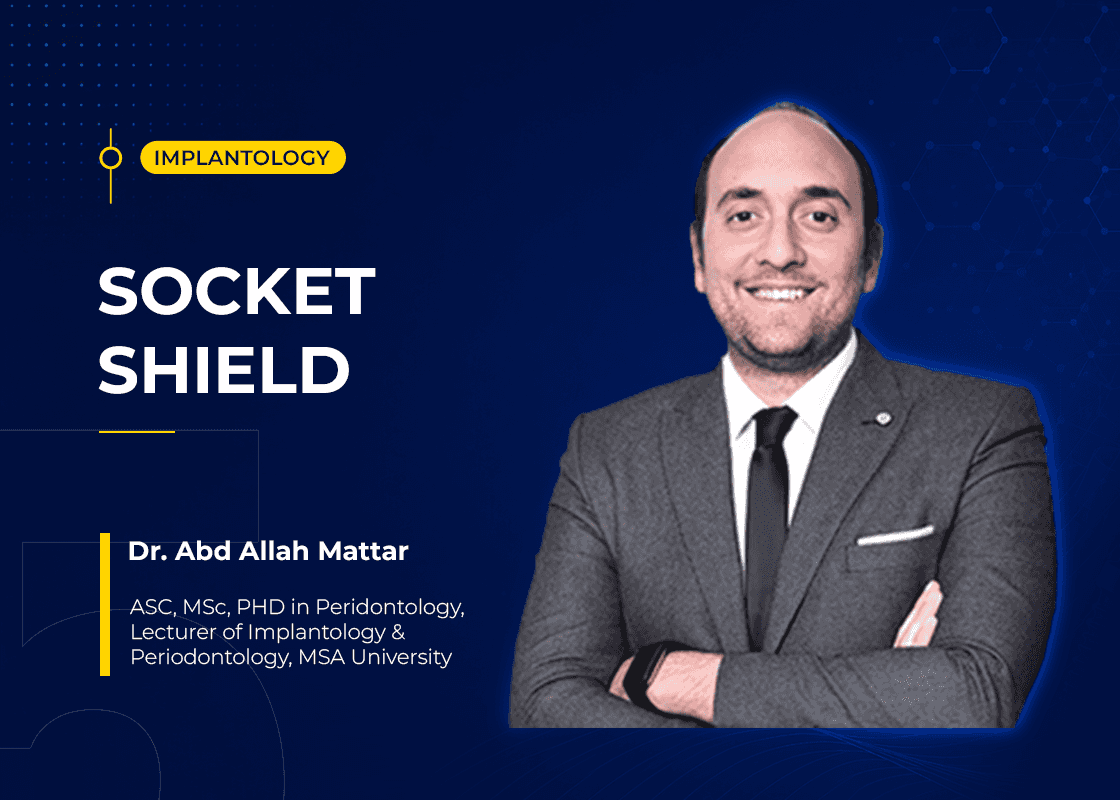 Socket Shield