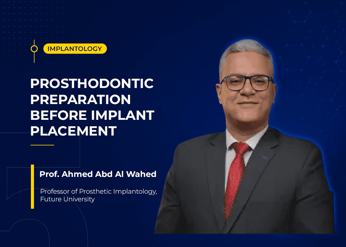 Prosthodontic Preparation before Implant
