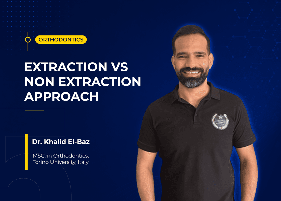 Extraction vs Non Extraction Approach - Course Preview