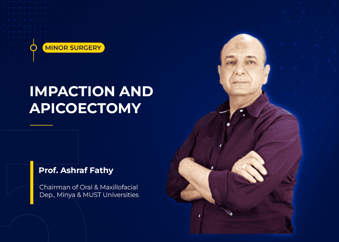 Impaction & Apicoectomy - Course Preview