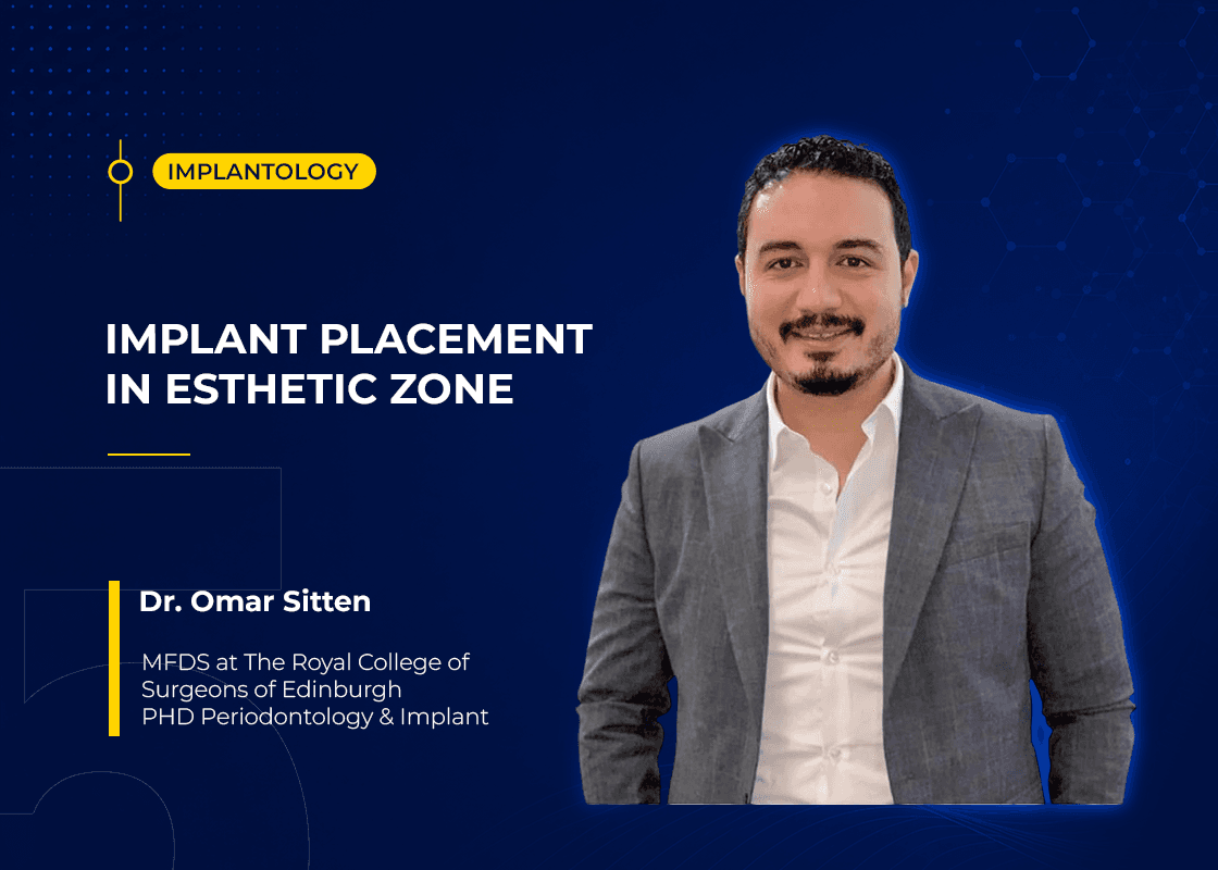Implant Placement In Esthetic Zone - Course Preview