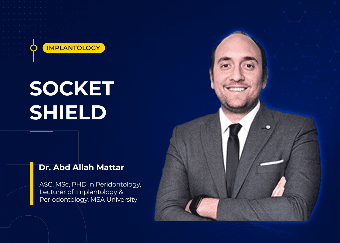 Socket Shield - Course Preview