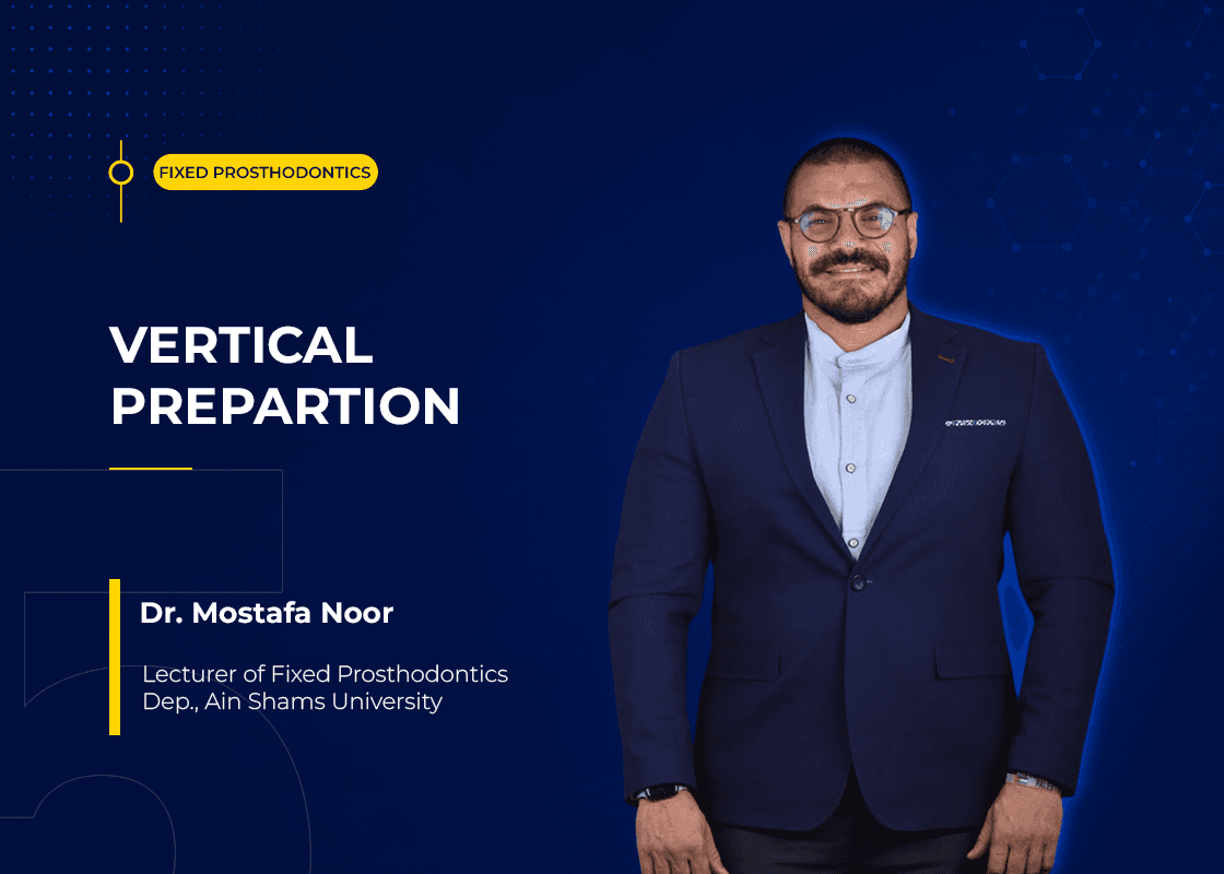 Vertical Prepartion - Course Preview