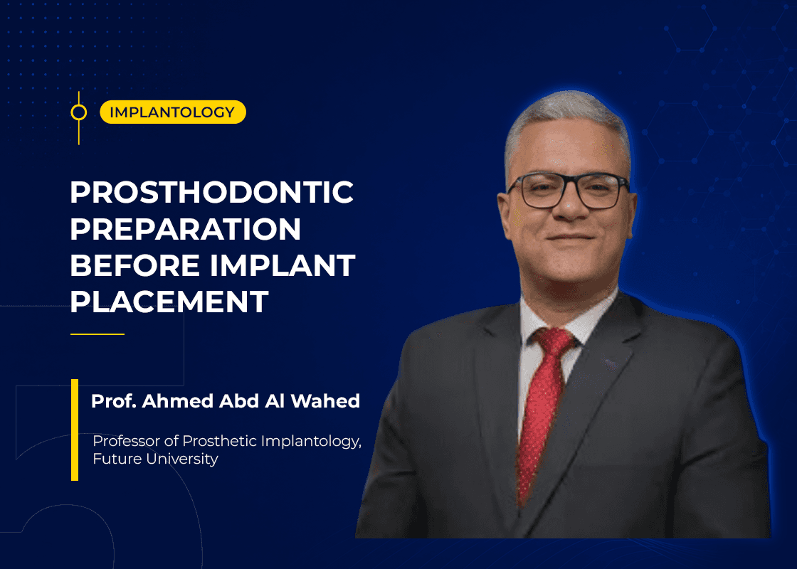 Prosthodontic Preparation before Implant