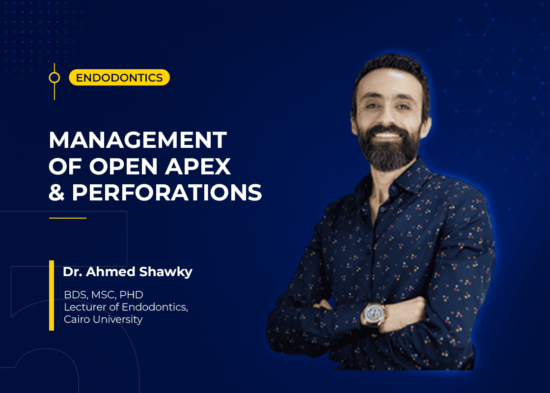 Management Of Open Apex & Perforations - Course Preview