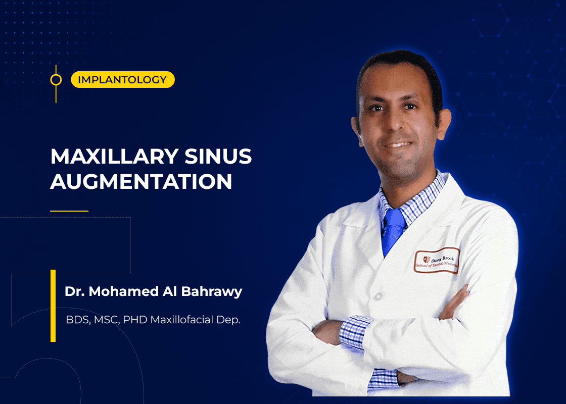Maxillary Sinus Augmentation - Course Preview
