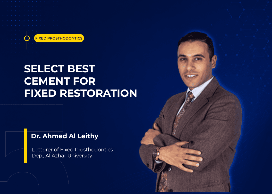 Select Best cement For Fixed Restoration - Course Preview